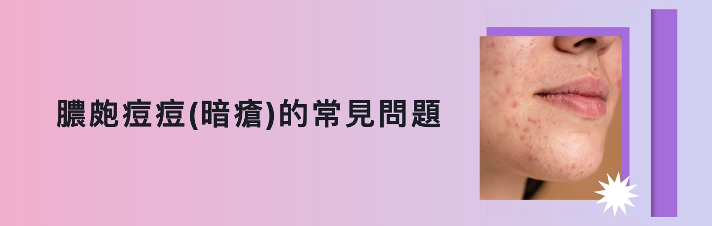 膿皰型痘痘的成因及處理方法 | Watsons HK 膿皰型痘痘的成因及處理方法