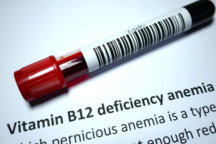 Vitamin B12 deficiency anemia - blood disorder abstract.